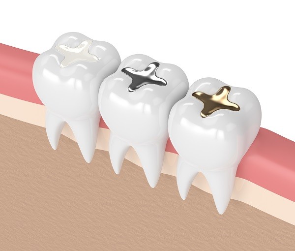 Tooth Filing